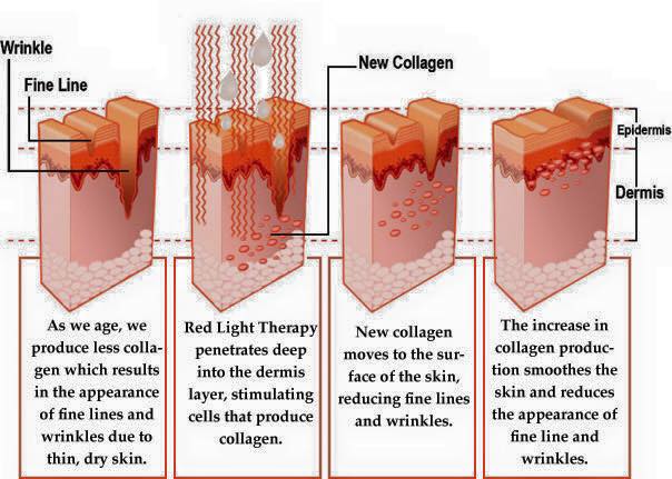 Red Light Therapy – Keeping Your Skin Young And Healthy